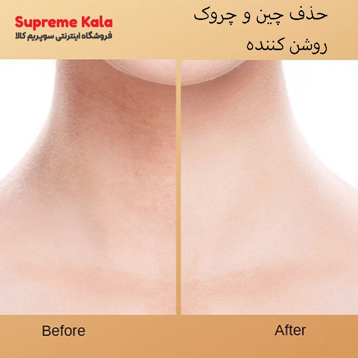 قبل و بعد استفاده از ماسک ورقه‌ای گردن بیوآکوا عصاره شیر بز و کلاژن