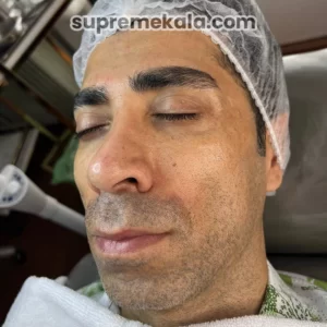 after-customer-satisfaction-1 (1)