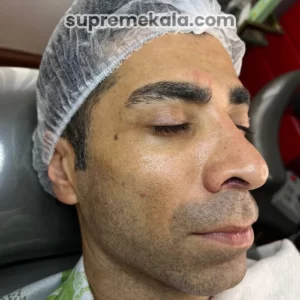 after-customer-satisfaction-1 (2)