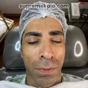 after-customer-satisfaction-1 (3)