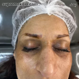 after-customer-satisfaction-2 (1)