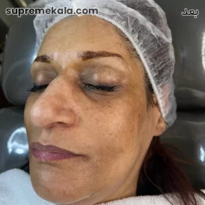 after-customer-satisfaction-2 (2)