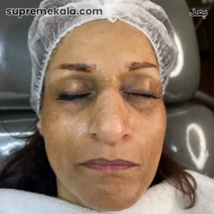 after-customer-satisfaction-2 (4)