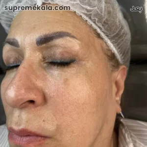 after-customer-satisfaction-3 (1)