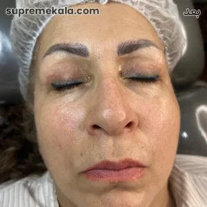 after-customer-satisfaction-3 (2)