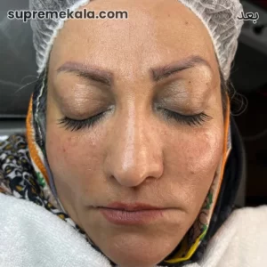 after-customer-satisfaction-4 (1)