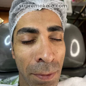 before-customer-satisfaction-1 (1)