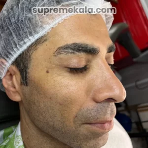 before-customer-satisfaction-1 (2)