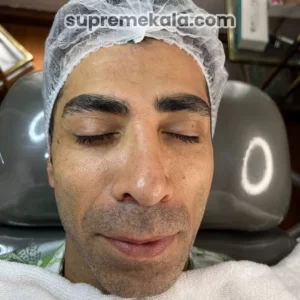 before-customer-satisfaction-1 (3)