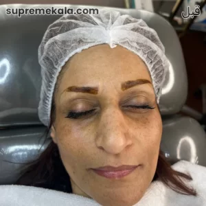 before-customer-satisfaction-2 (1)