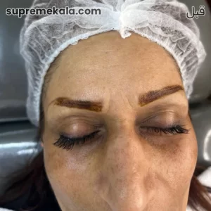 before-customer-satisfaction-2 (2)