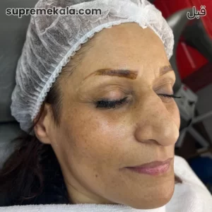 before-customer-satisfaction-2 (4)