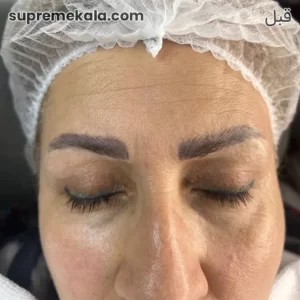 before-customer-satisfaction-3 (1)