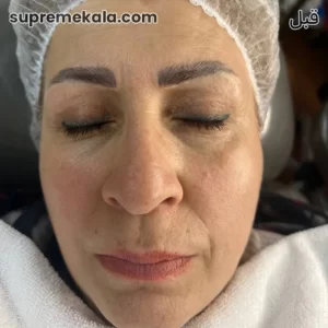 before-customer-satisfaction-3 (2)