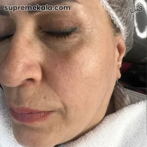 before-customer-satisfaction-3 (3)