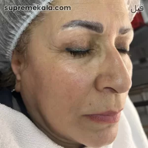 before-customer-satisfaction-3 (4)