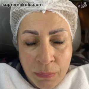 before-customer-satisfaction-3 (5)