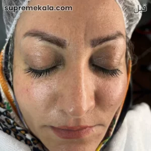 before-customer-satisfaction-4 (1)