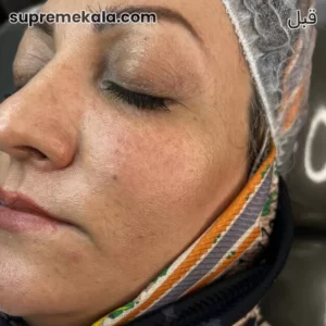 before-customer-satisfaction-4 (2)