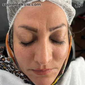 before-customer-satisfaction-4 (3)