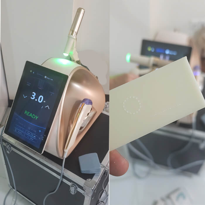 تست شات کارتریج صورت و ویمکس دستگاه هایفو 12 بعدی گلد