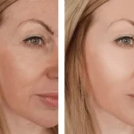 بى سيركادين، سرم جوانساز تنورا 30 میل - تصویر 2