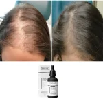 سرم بايو هير كوكتل مهار كننده DHT تنورا 50 میل - تصویر 2