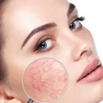 سرم امولسيونى ضد حساسيت تنورا 50 میل - تصویر 2