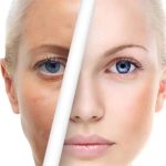 اسید لایه بردار بى آر انزيم كاركتور پيل تنورا 100 میل - Image 2