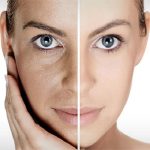 اسید لایه بردار بايو سل كاركتور پيل تنورا 100 میل - Image 2