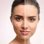 سرم ضد لک قوی دکتر بلتر 30 میل - تصویر 2