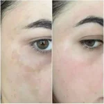 LS - کرم ضد لک قوی و درخشان کننده SPF30 دکتر بلتر 100 میل - Image 2