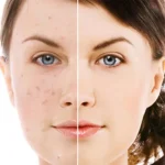 LS - کرم ضد لک قوی و درخشان کننده SPF30 دکتر بلتر 50 میل - تصویر 2