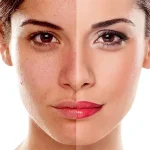 کرم پیلینگ ملایم دکتر بلتر 250 میل - Image 2