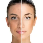 فلوئید دو فاز ضد جوش فوری دکتر بلتر 9 میل - تصویر 2