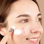 کرم ضد جوش دکتر بلتر 100 میل - تصویر 2