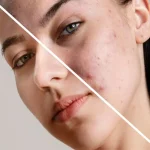 لوسیون ضد جوش دکتر بلتر 500 میل - تصویر 2