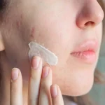 کرم پودر ضد جوش شماره 0 دکتر بلتر 30 میل - تصویر 2