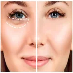 بالم مغذی و جوانساز دور چشم Nutritiv دکتر بلتر 15 میل - تصویر 2