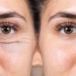 کرم دور چشم ضد چروک Biomimetic دکتر بلتر 15 میل - تصویر 2