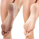 کرم بسیار قوی کنترل ترک پا دکتر بلتر 30 میل - تصویر 2