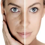 کرم پر کننده خطوط دور چشم Biodynamic دکتر بلتر 15 میل - Image 2