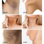 كرم سفيد كننده بدن تنورا 75 میل - تصویر 2