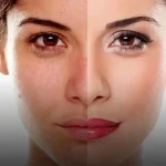 مرطوب كننده بر پايه آب آنتى باكتريال تنورا 100 میل - تصویر 2