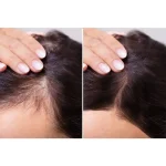 ويال كوكتل مو قابليت جذب با نيدلينگ تنورا 5*10 میل - تصویر 2