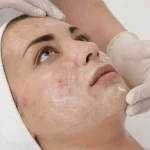 اسید های میوه 20 % دکتر بلتر 50 میل - Image 2